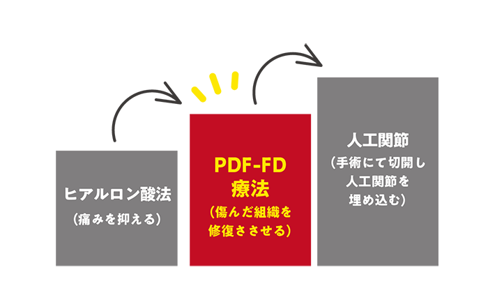 PDF-FD療法のイメージ
